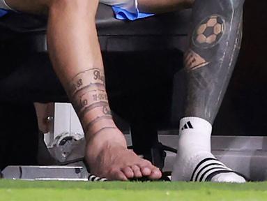 Kaki Lionel Messi tampak bengkak saat pertandingan final Copa America 2024 melawan Kolombia. (AFP/Carmen Mandato)