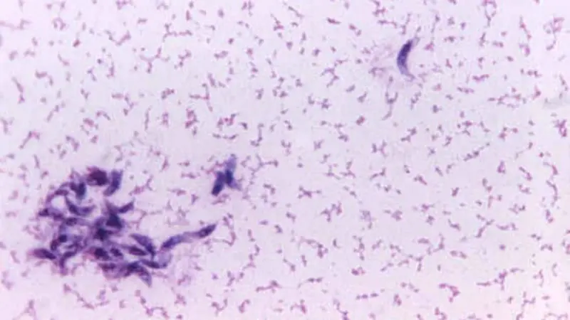 Toxoplasma gondii (0)