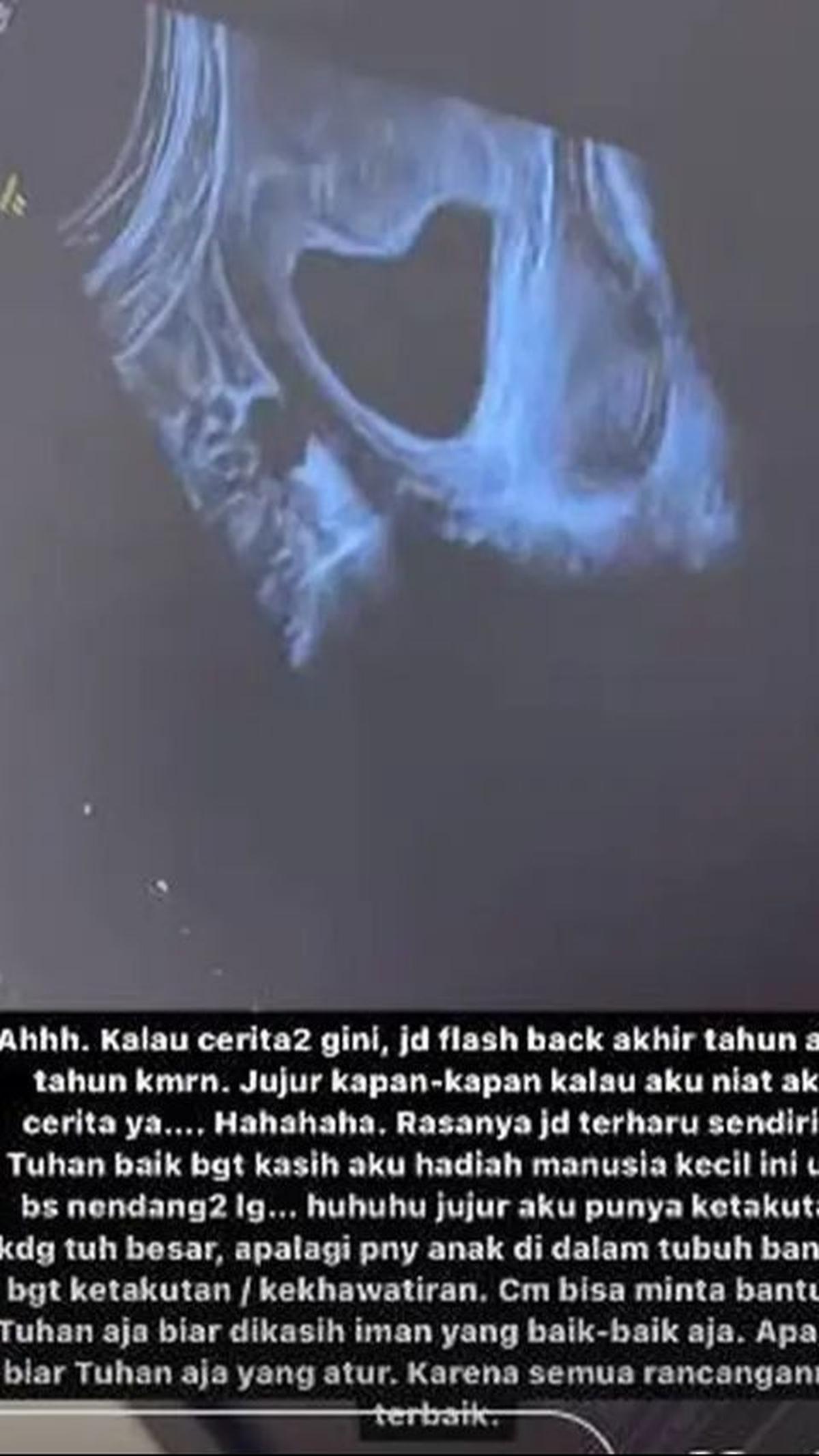 Ternyata Shanju sudah merasakan kehamilannya sejak akhir tahun kemarin.