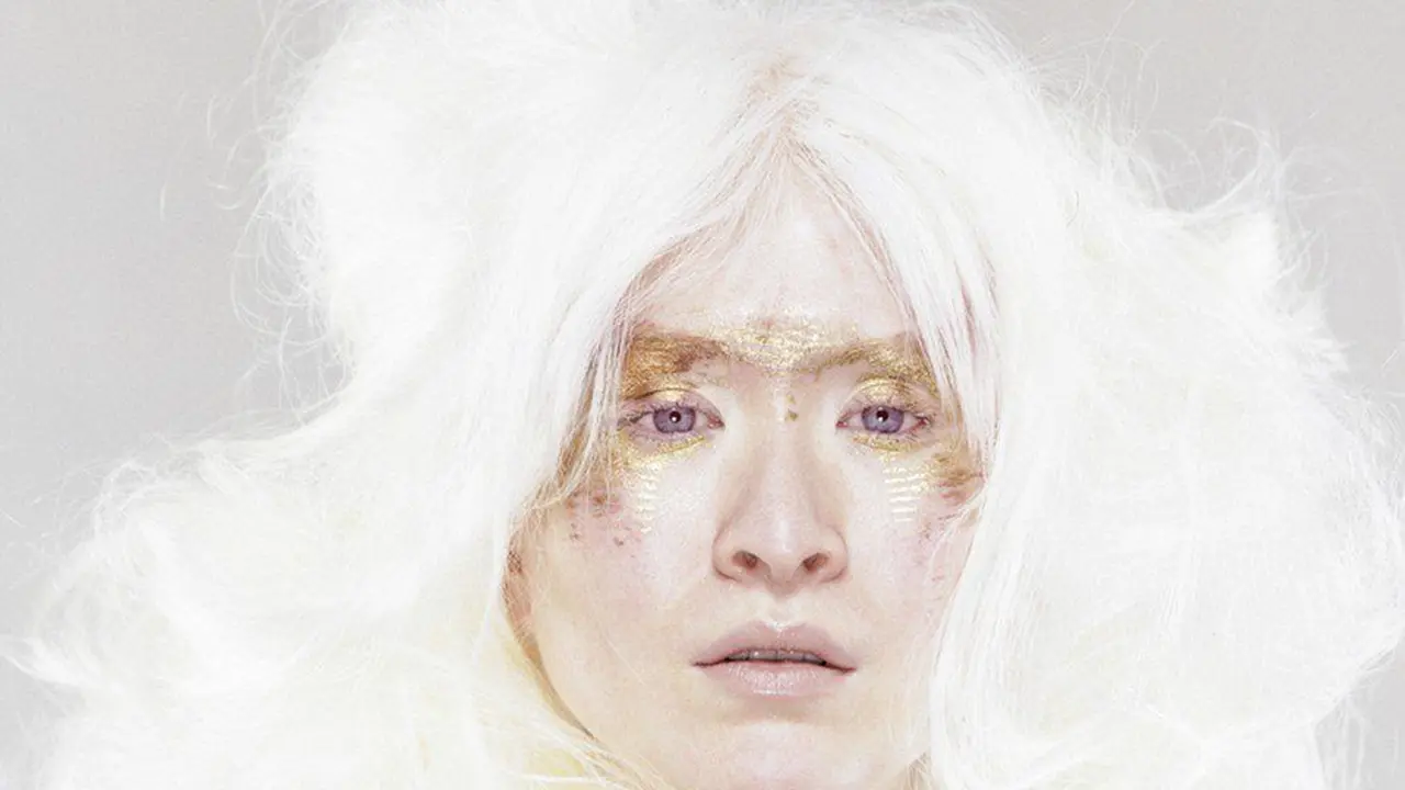 [Fimela] Connie Chiu, model albino yang mengubah perbedaan jadi kelebihan