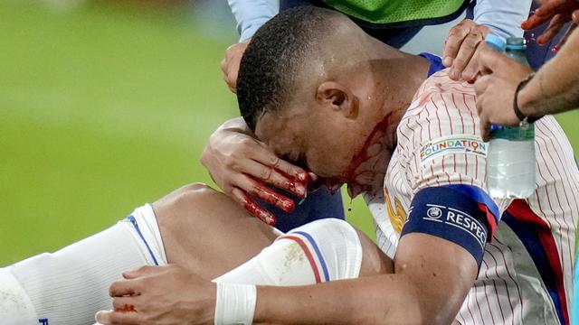 Foto: Momen Benturan Keras Kylian Mbappe dengan Pemain Austria, Berdarah-darah Hingga Tulang Hidung Patah