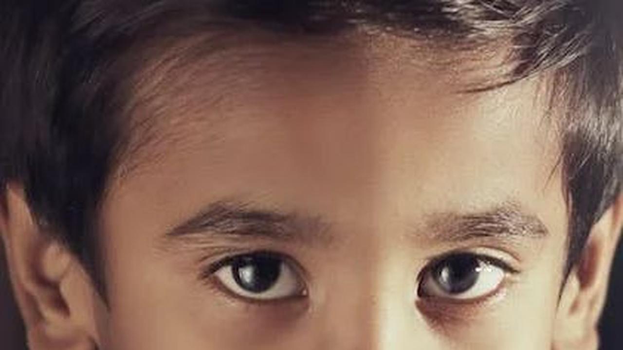 Berikut adalah beberapa cara yang bisa Bunda lakukan untuk mengatasi bibir kering yang dialami Si Kecil: