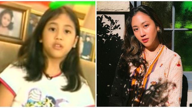 6 Potret Dulu Vs Kini Artis Cilik yang Punya Pipi Menggemaskan, Bikin Pangling