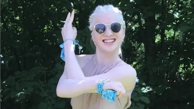 Cerita Wanita Albino Pernah Dibuang di Panti Asuhan Kini Jadi Model Terkenal
