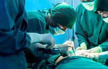 Membedah Akar Masalah Polemik Dokter Asing