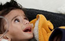 FOTO: Krisis Kelaparan di Gaza Makin Memburuk, Kondisi Anak-Anak Palestina Kurus Menderita Malnutrisi Akut di Rumah Sakit