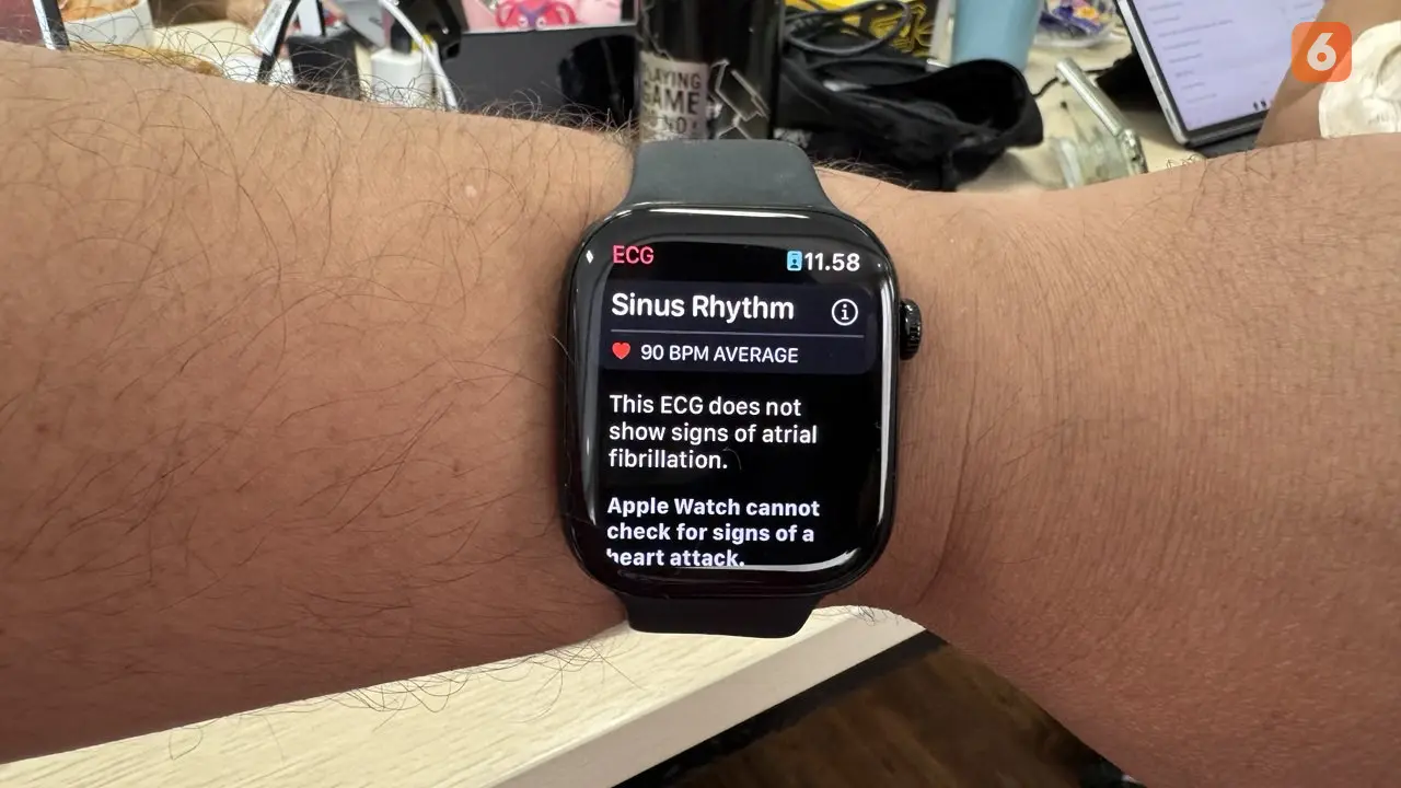 Apple Watch