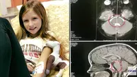 Didiagnosis Tak Lama Hidup, Tumor Otak Gadis 11 Tahun Ini Hilang Secara Ajaib