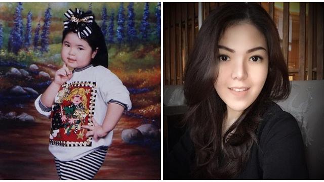 6 Potret Dulu Vs Kini Artis Cilik yang Punya Pipi Menggemaskan, Bikin Pangling