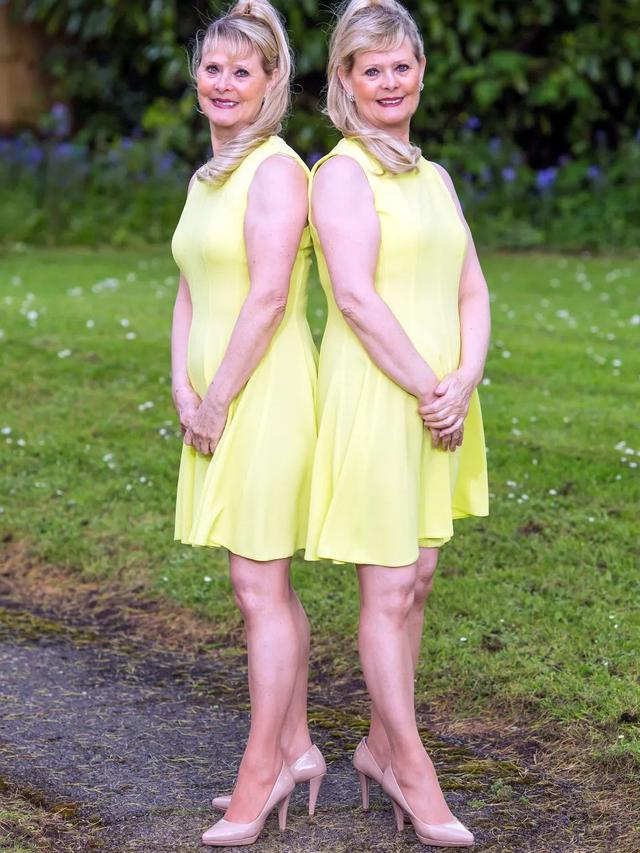 Potret Kembar Identik yang Kenakan Pakaian Serasi Selama 23 Tahun