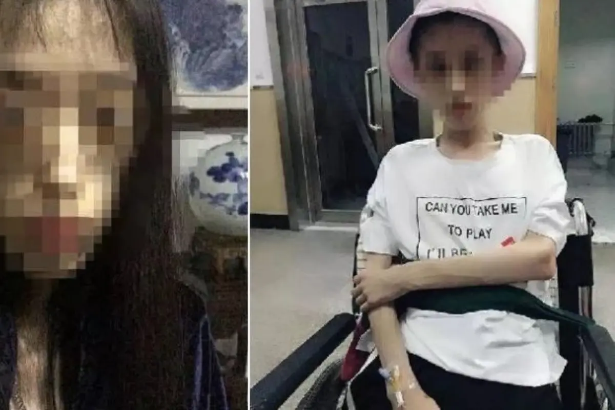 [Bintang] Dibilang Gendut Perempuan Ini Jalani Diet Ekstrem, Kini Beratnya Hanya 25 Kg