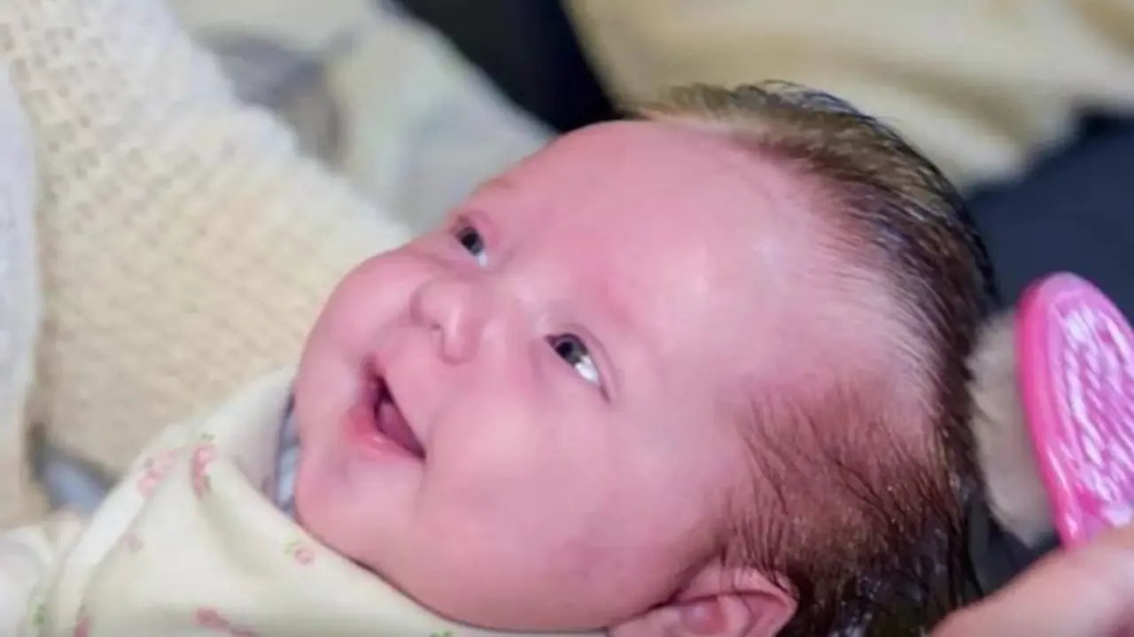 Gemas, Bayi Baru Lahir Penuh Rambut Jalani Perawatan Tiap Hari