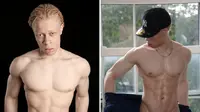 Albino Kulit Hitam Sukses Jadi Model
