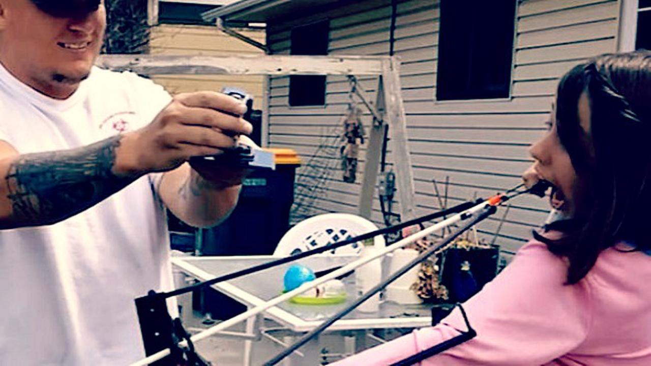 Gadis Belasan Tahun Cabut Gigi Ditarik Pakai Busur