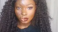 Makeup Bantu Wanita dengan Luka Bakar Ini Tampil Percaya Diri