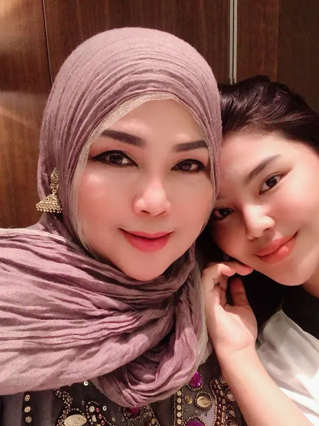 Bak Pinang di Belah Dua, Ini 6 Potret Rosa Meldianti dan Ibunda