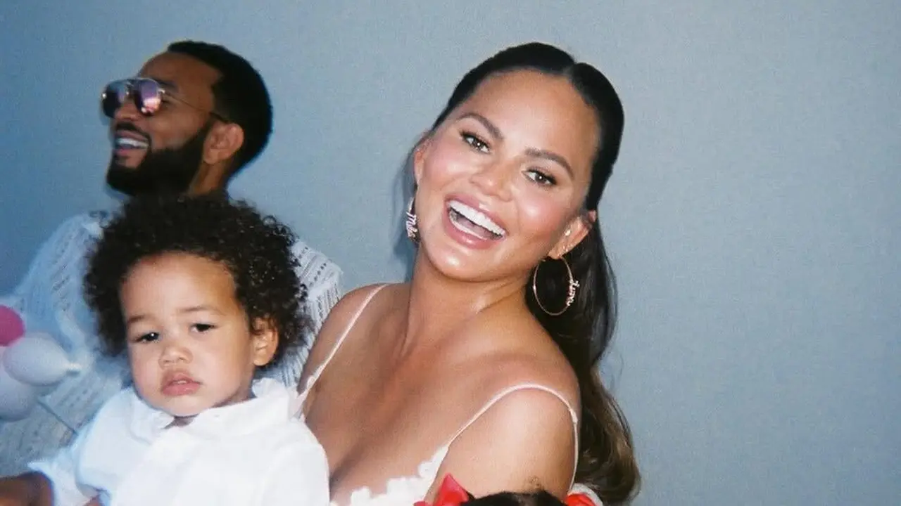 Chrissy Teigen Jalani Operasi Hairline Lowering Akibat Rambut Rontok Pasca Melahirkan