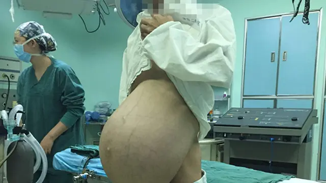 Bak Hamil, Pria Ini Idap Tumor di Perut Selama 10 Tahun