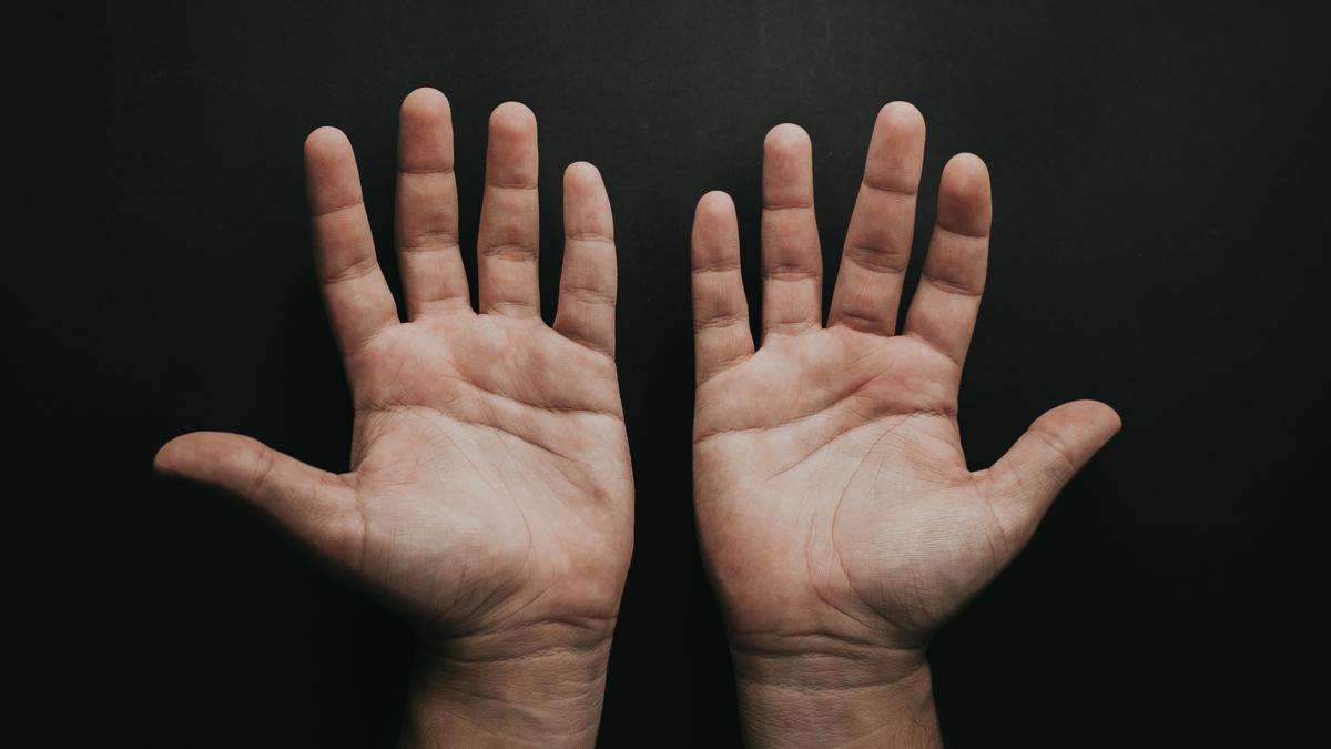 Apa Itu Simian Line? Garis Lurus di Telapak Tangan yang Langka