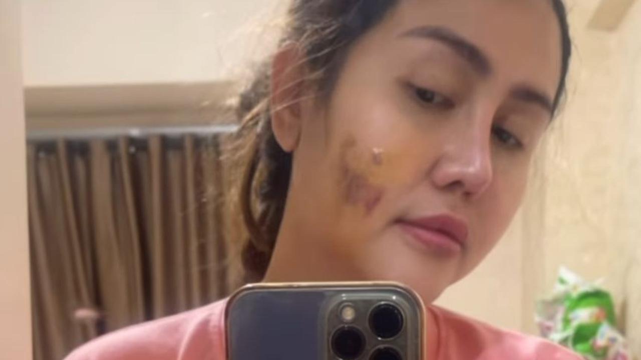 Pedangdut Ratu Meta Unggah Video Cekcok dengan Suami, Ungkap Kekerasan yang Diduga KDRT