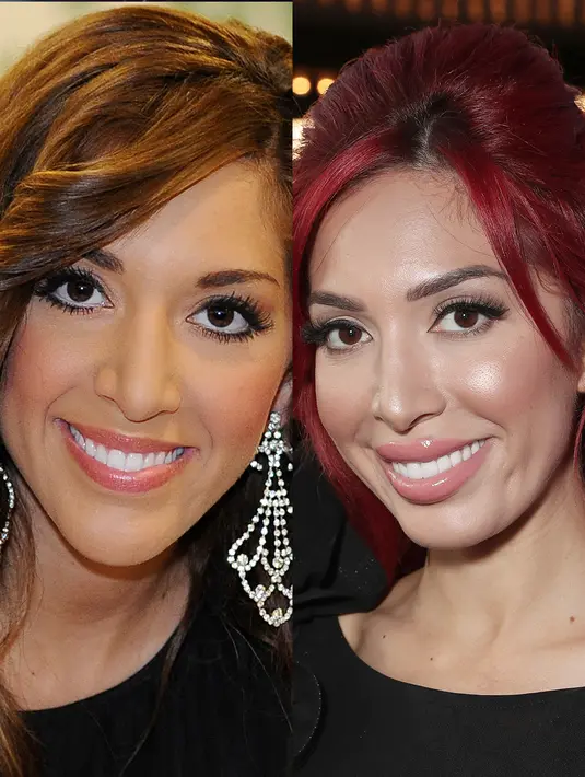 Farrah Abraham adalah salah satu orang yan paling terbuka mengenai operasi plastik yang ia jalani. (REX/Shutterstock/HollywoodLife)