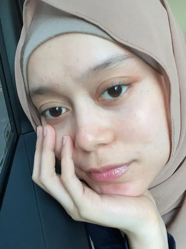 Disebut Berjerawat, Ini 6 Potret Lesty Kejora Tanpa Makeup