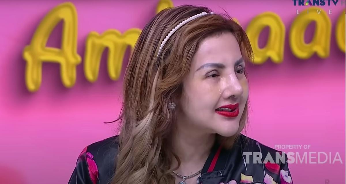 Demi Tampil Sempurna, Barbie Kumalasari Rogoh Ratusan Juta untuk Operasi Plastik ke-9 Kalinya