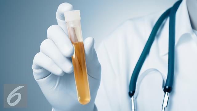 Ilustrasi Foto Air Seni atau Urine