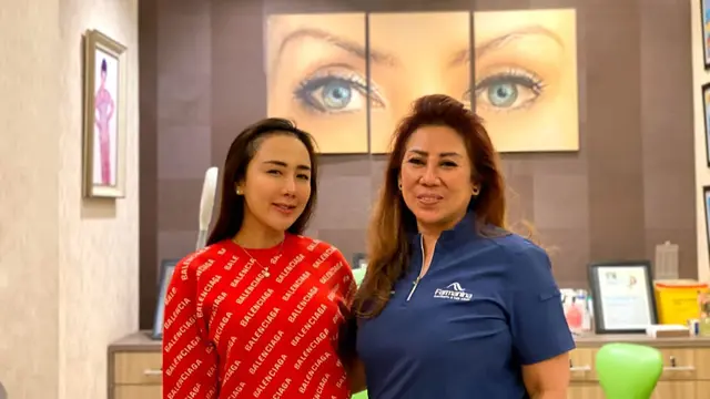 Ucie Sucita lakukan transplantasi rambut (Istimewa)