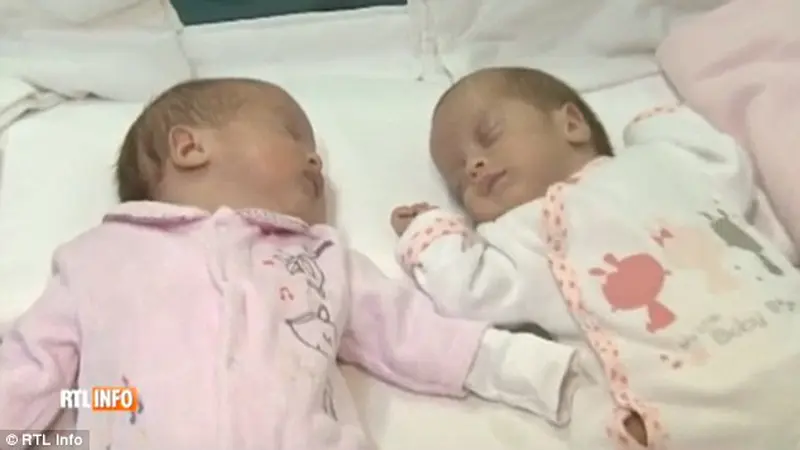 Ibu Lahirkan Bayi Kembar yang Terpisah Dua Bulan