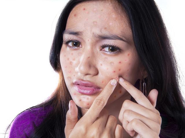 12 Cara Menghaluskan Kulit Wajah Secara Alami Sehat Dan Ampuh Hot Liputan6 Com
