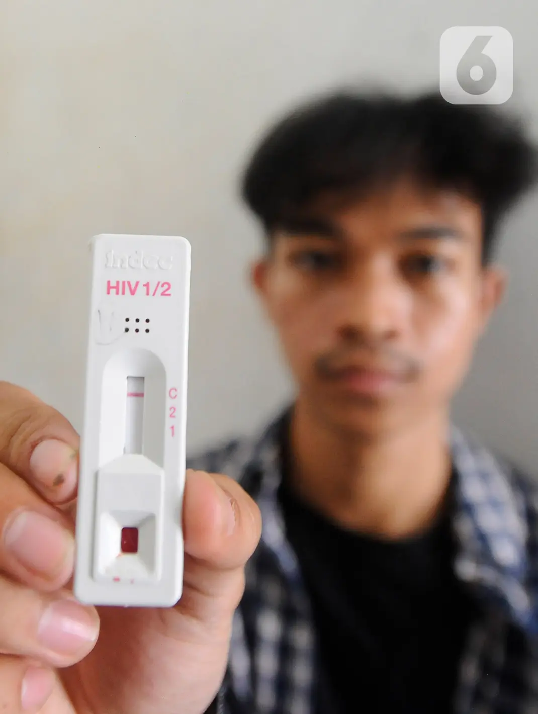 Kegiatan VCT Mobile Cegah Penularan HIV/AIDS di Kalangan Mahasiswa
