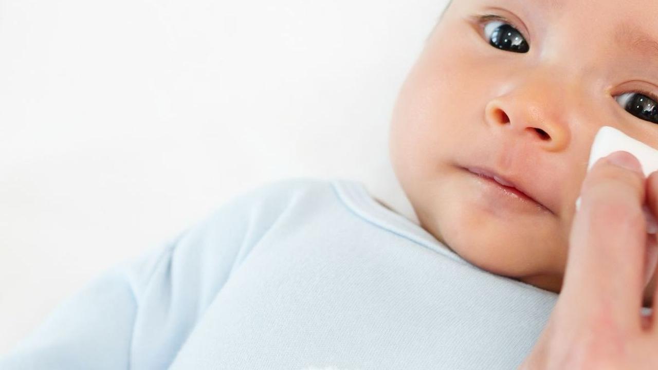 Cara Mengatasi Kulit Bayi Gatal