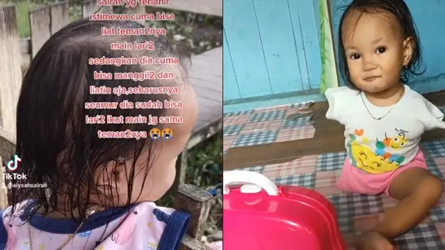 Tak Pernah Menyerah, Semangat Balita Tunadaksa saat Bermain Ini Bikin Salut