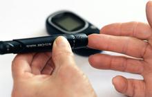Kaki Menghitam Jadi Salah Satu Gejala Diabetes, Intip Gejala Lainnya yang Wajib Diwaspadai