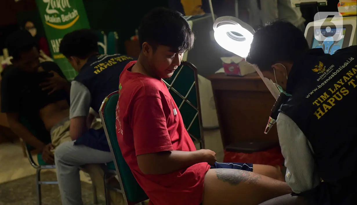 Baznas (Bazis) wilayah Jakarta Timur bersama Islamic Medical Service menggelar layanan hapus tato gratis bagi masyarakat saat Ramadhan. (Liputan6.com/Herman Zakharia)