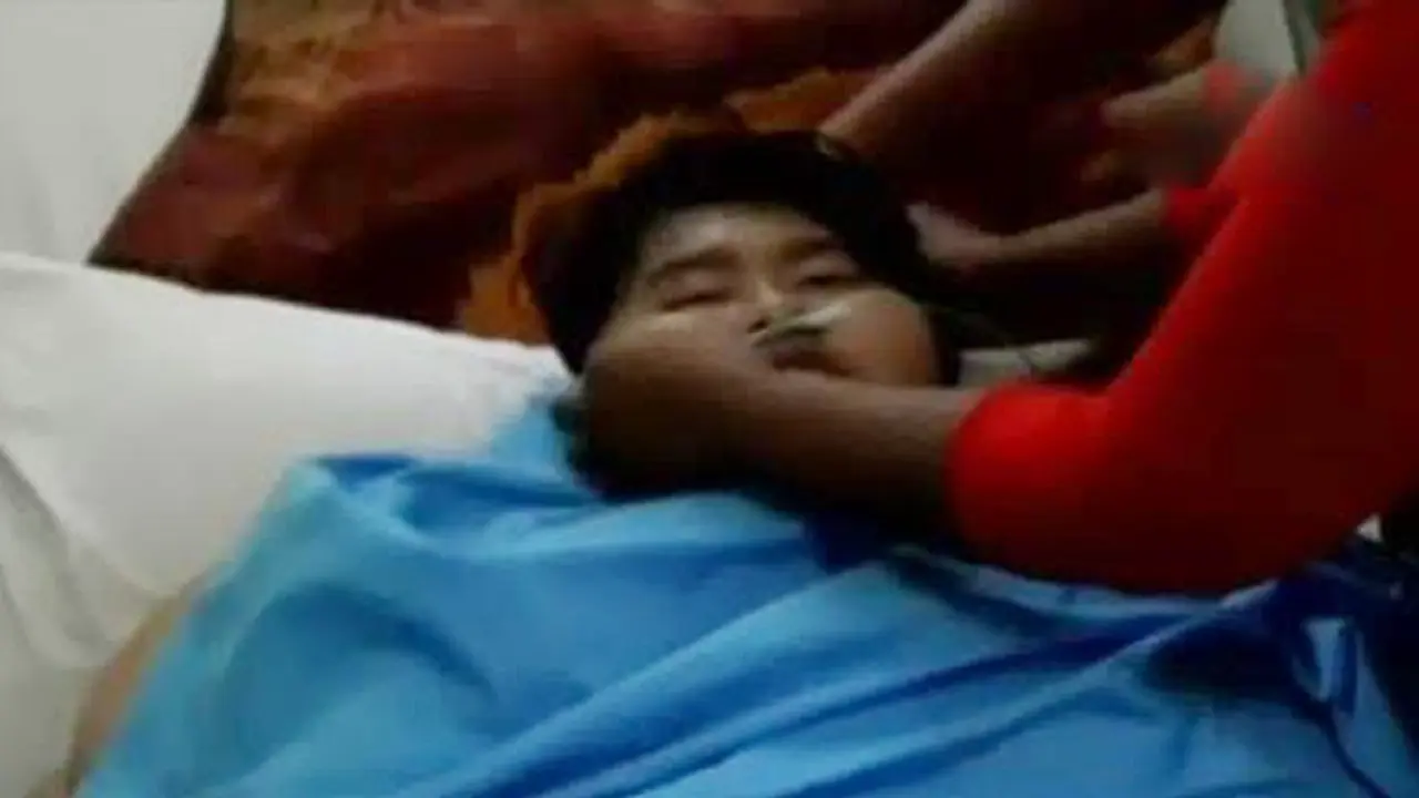 Gadis Obesitas Sidoarjo Dirujuk ke RS Dr Sutomo Surabaya