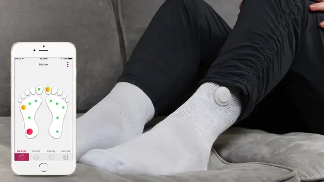 Siren, kaos kaki pintar untuk pantau diabetes.