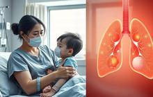 Kenali Apa Itu Bronkopneumonia, Infeksi Paru yang Sering Membahayakan Anak dan Perlu Dipahami oleh Orangtua