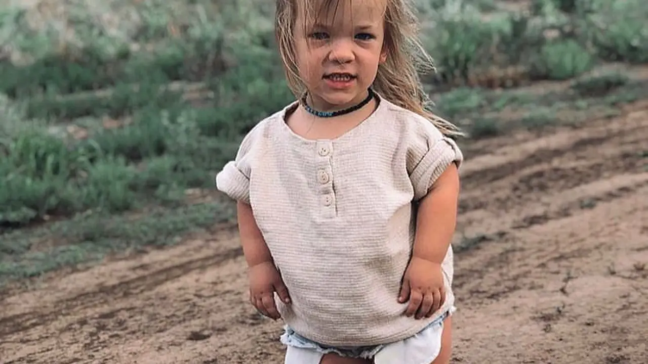 Achondroplasia