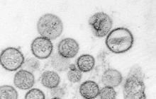 BRIN: Risiko Hantavirus Menjadi Pandemi di Indonesia Rendah, Kewaspadaan Tetap Diperlukan