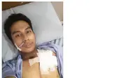 Sosok pria bernama Robby Indra Wahyuda (27) dengan kondisi leher berlubang karena terkena kanker pita suara akibat kebiasaan merokok sejak umur belasan tahun. (Foto: Facebook/ Robby Indra Wahyuda)