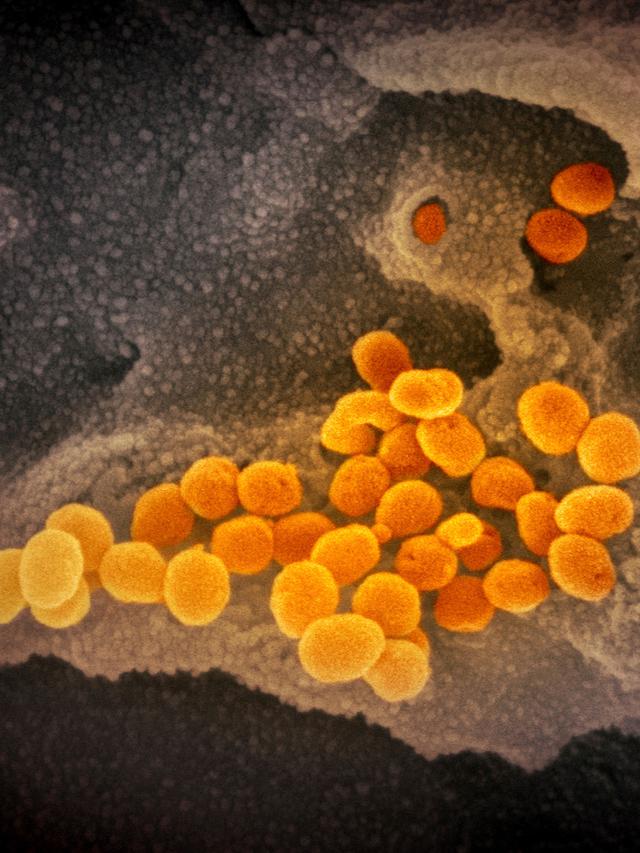 Virus Corona COVID-19 dari Mikroskop