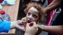 Vaksinasi tahap pertama dilakukan di bulan September setelah seorang bayi mengalami kelumpuhan sebagian akibat virus polio tipe 2 pada bulan Agustus lalu. (Eyad BABA/AFP)