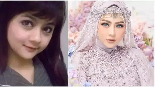 Potret Jenita Janet sebelum dan sesudah tanam benang (Sumber: Instagram/@jenitajanet)