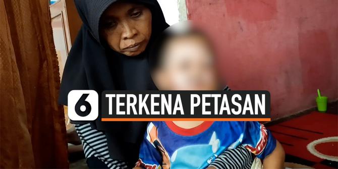 VIDEO: Lepas Pengawasan Orangtua, Balita Terbakar Terkena Petasan