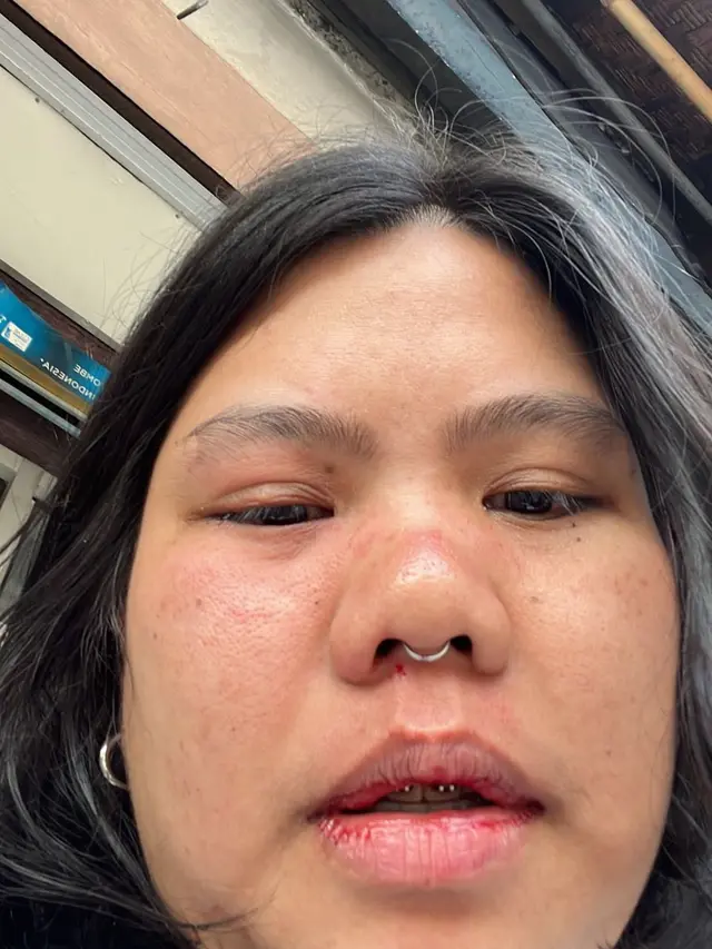 Wanita di Bali dianiaya oleh ojol karena pertanyaannya tidak direspon selama perjalanan