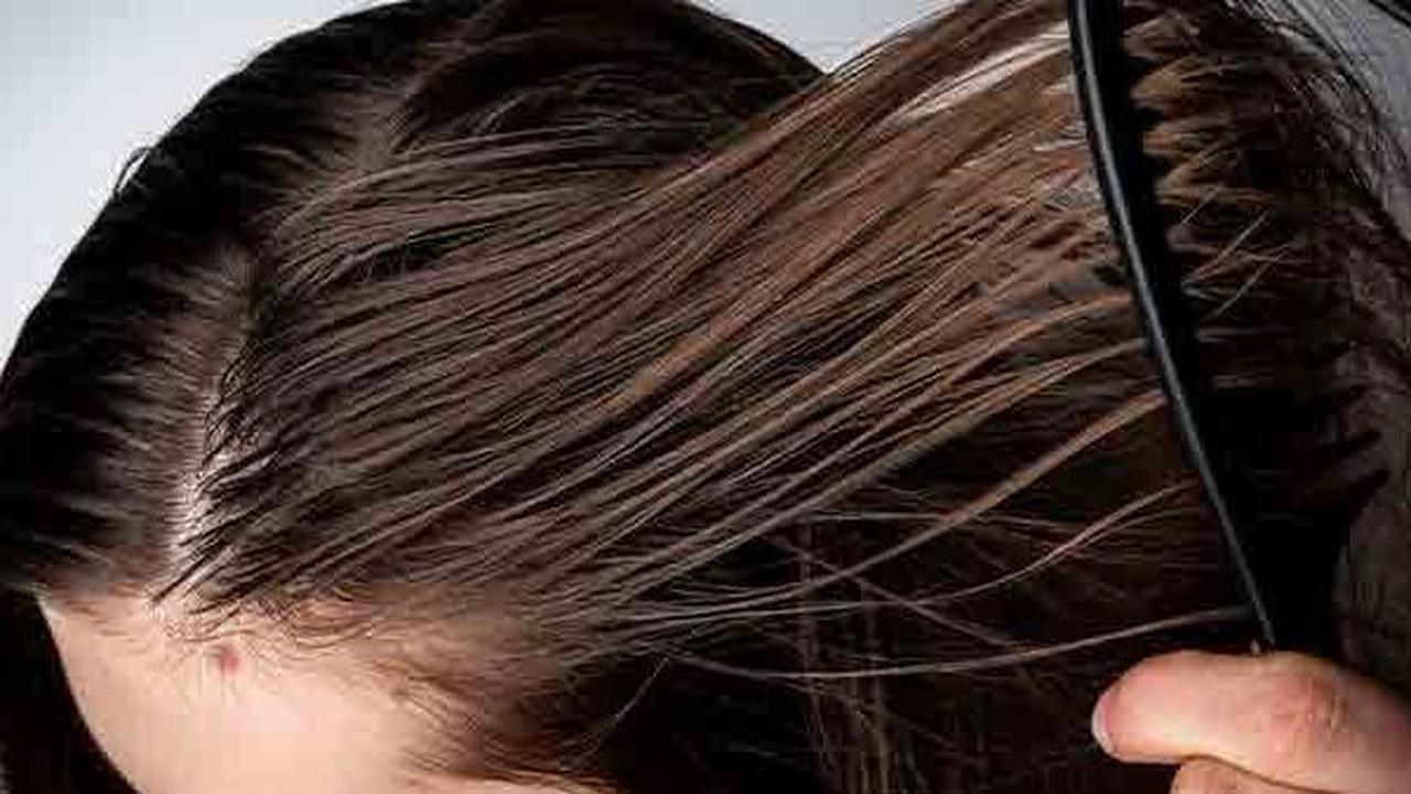 Penyebab Rambut Berminyak