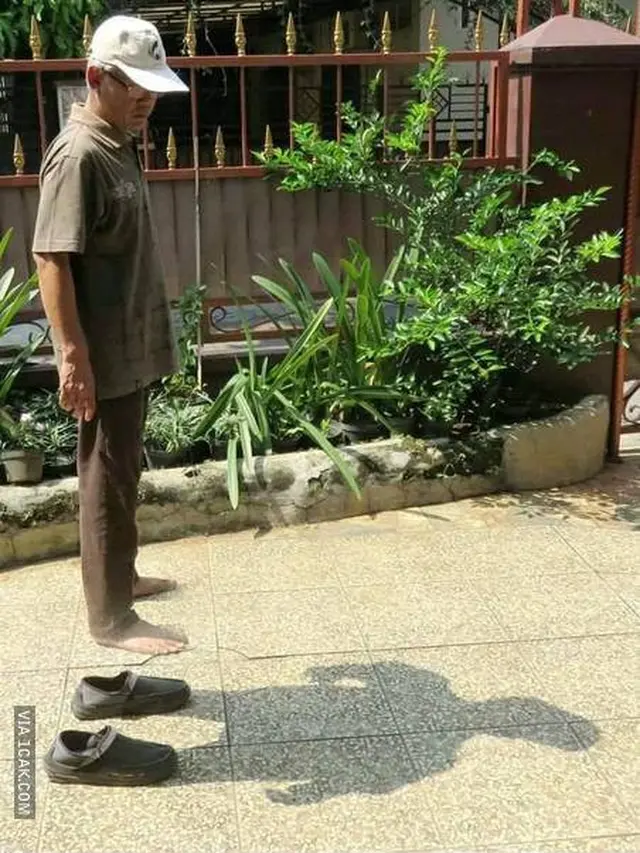 9 Potret Tangan dan Kaki Orang 'Ngebug' Ini Bikin Bingung Lihatnya