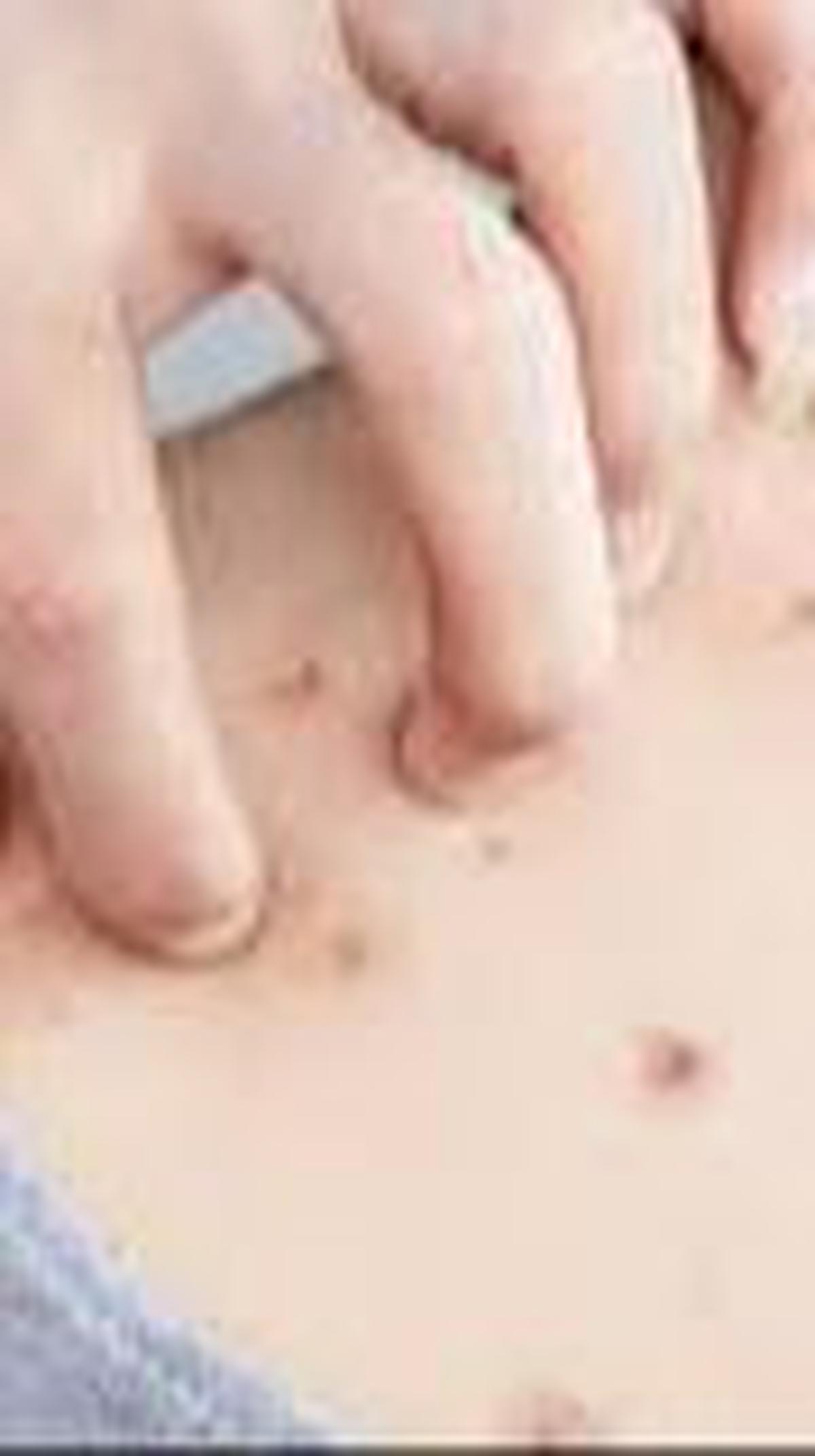Cara Mencegah Jerawat di Badan<br>